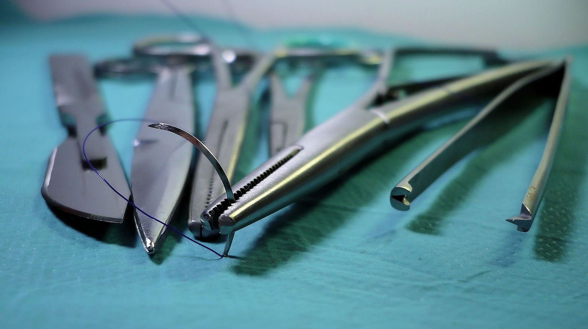 Pilonidal Sinus Laser Closure (SiLaC)