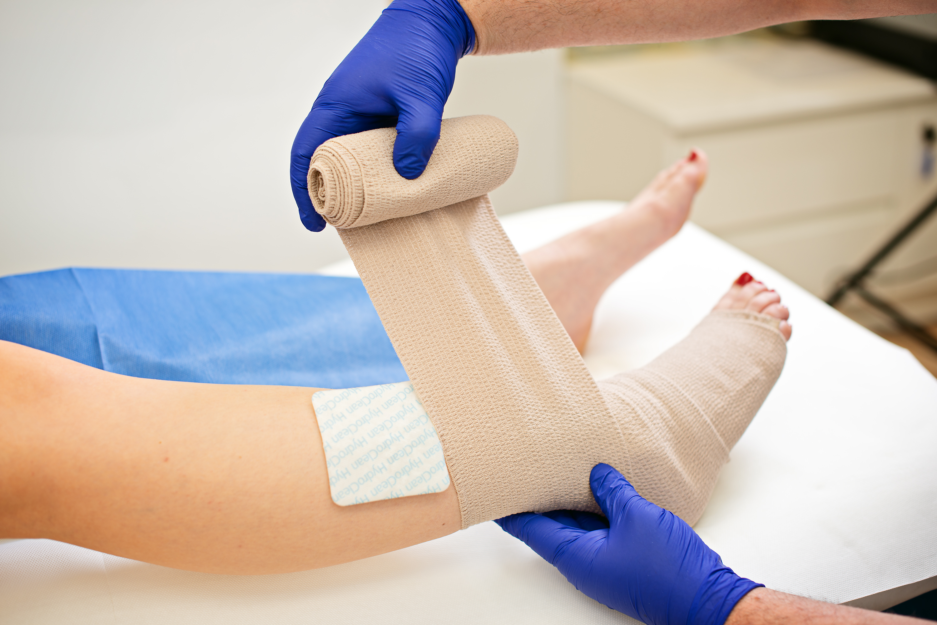 5 most common myths about varicose veins